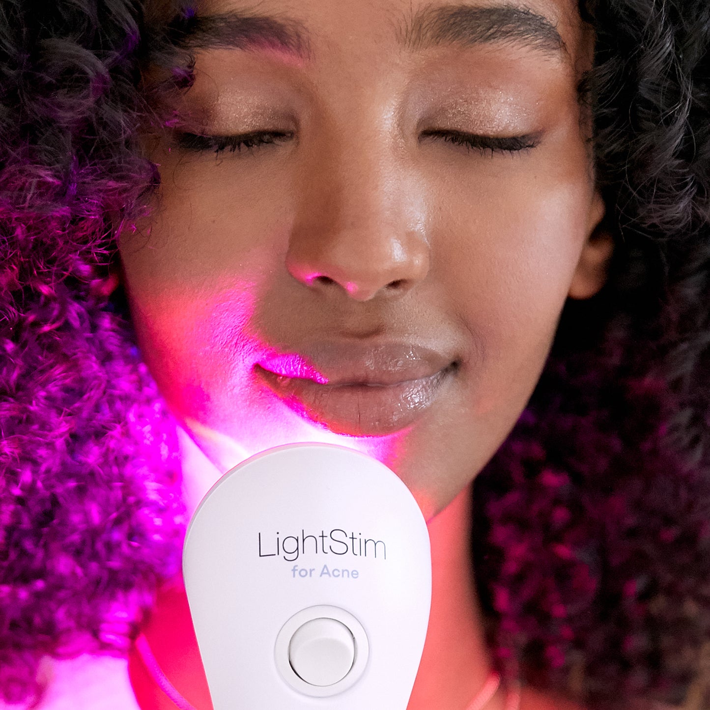 LightStim for Acne